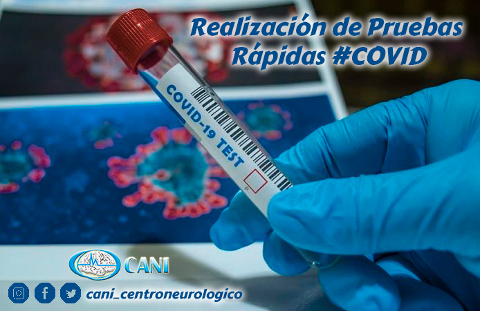 REALIZACION DE PRUEBAS RAPIDAS COVID 19 PRUEBAS RAPIDAS PARA LA DETECCION DE ANTICUERPOS.